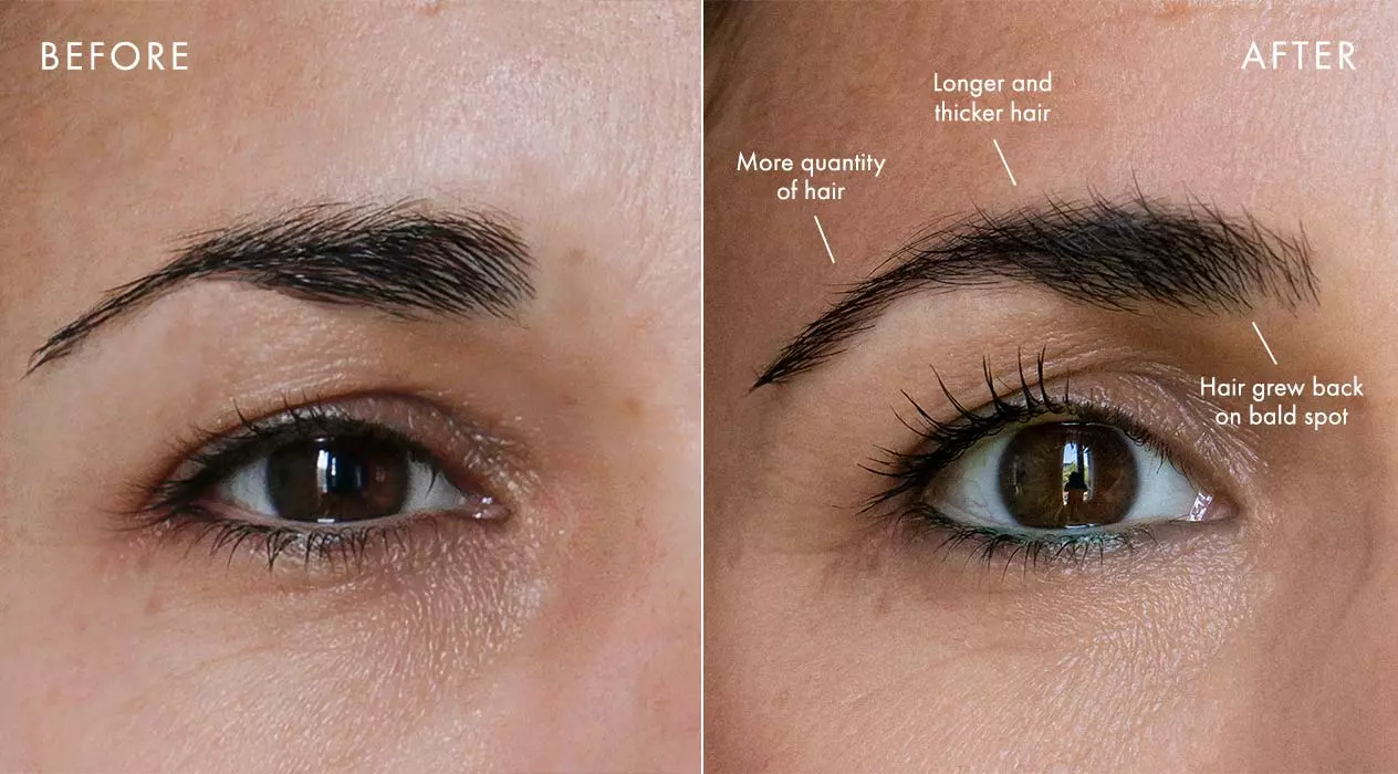 Demonstration of Brow Growth Before and After